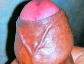 Rakeshkumarayush35